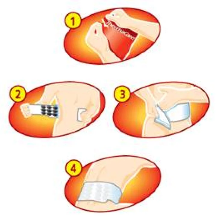 Thermacare Fasce Autoriscaldanti Schiena 2 pezzi