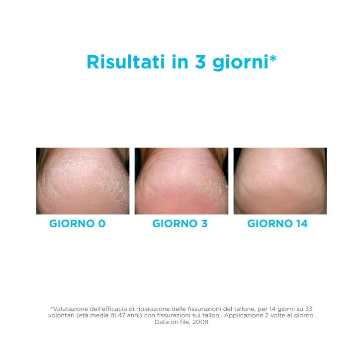 Isdin Ureadin Podos Gel Detergente Piedi Secchi 75 ml
