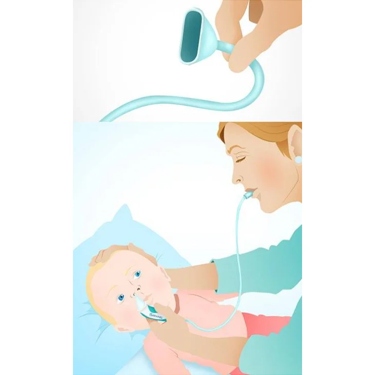 Narhinel Aspiratore Nasale Soft