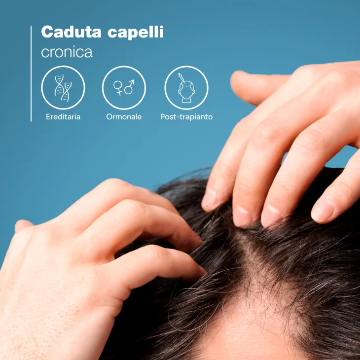 Ducray Anaphase+ Shampoo  Anticaduta Fortificante 200 ml