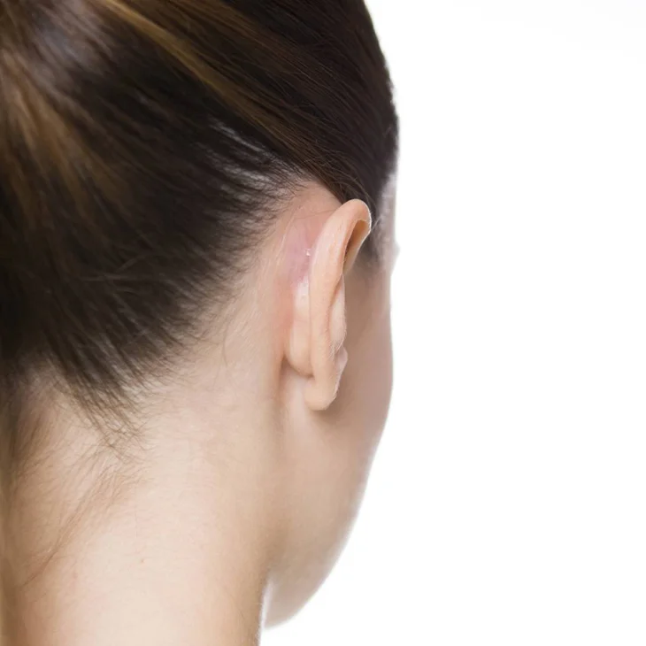 Otostick Adulti Correttore Orecchie Prominenti