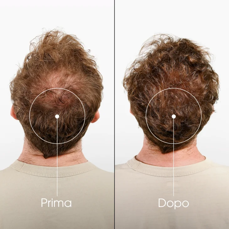 Klorane Shampoo Fortificante & Stimolante alla Chinina Stimola la crescita dei capelli 200ml