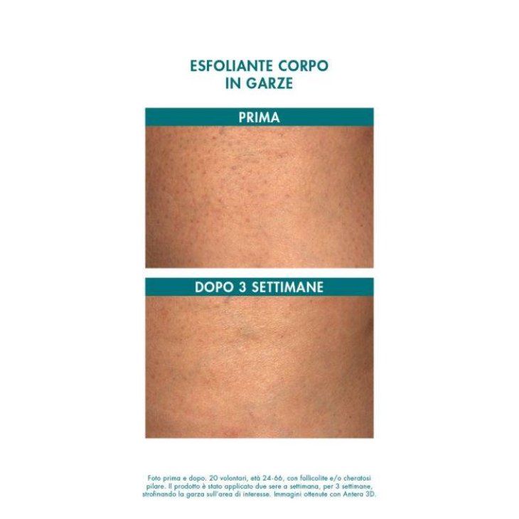 Miamo Alpha Blend 13% Exfoliating Body Garze Esfoliante 6 pezzi