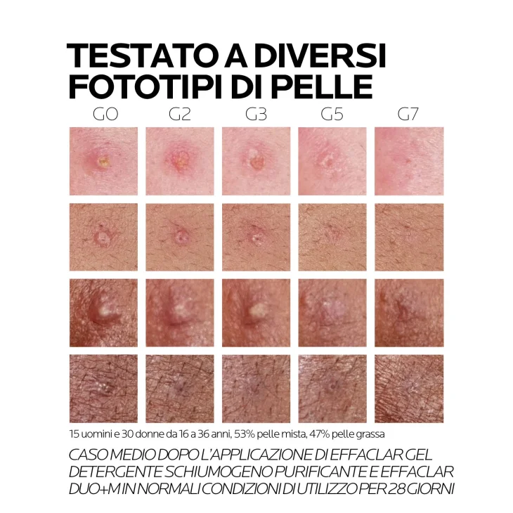 La Roche Posay Effaclar Duo +M Trattamento Tripla Correzione Anti-Acne Brufoli Imperfezioni Viso 40 ml