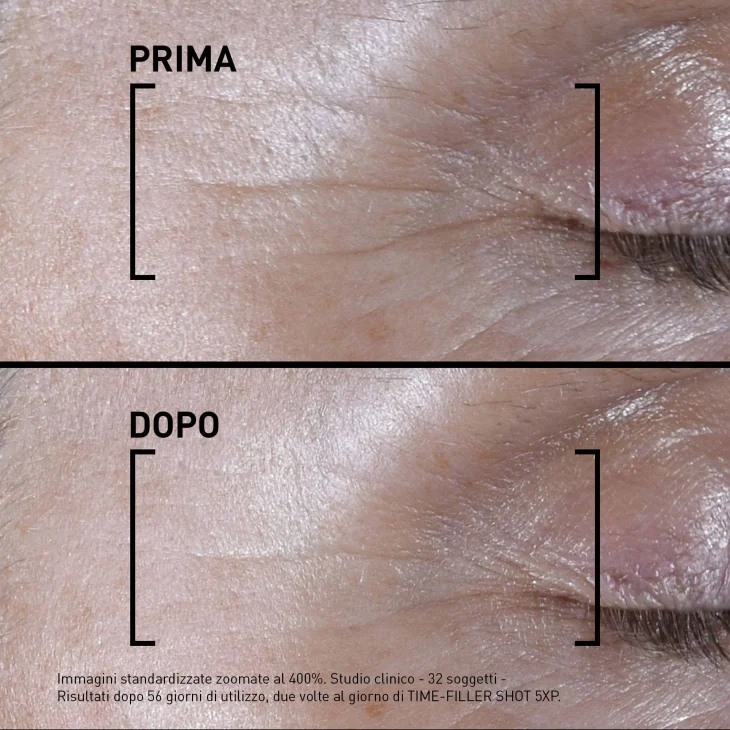 Filorga Time Filler Shot 5XP Siero Concentrato Antirughe Linee di Espressione 15 ml