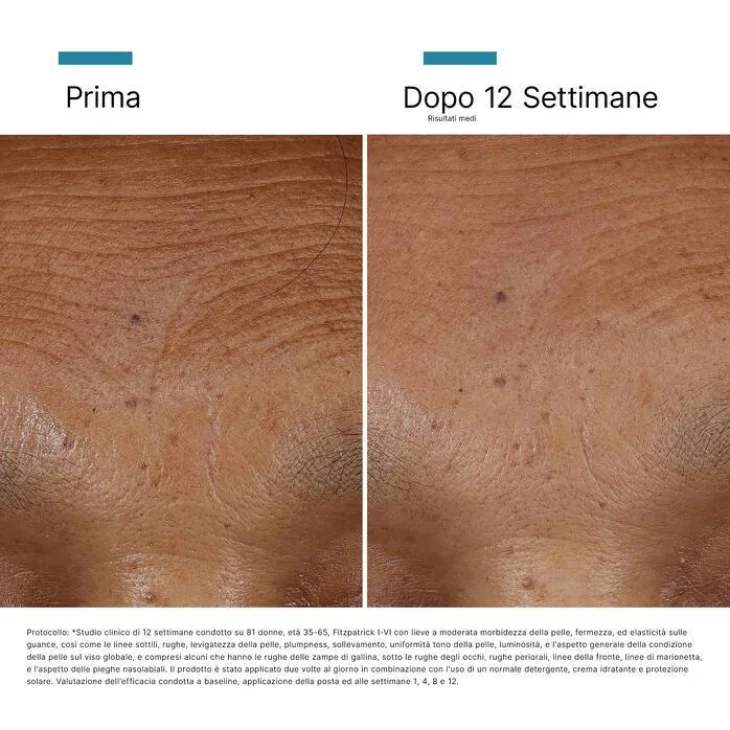 SkinCeuticals HA Intensifier Multi-Glycan Siero multi-dimensionale volumizzante 30 ml