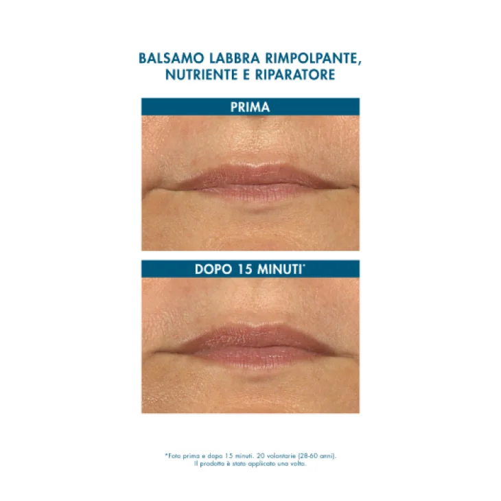 Miamo Hyalu-Repair Lip Balm ai Frutti Rossi Limited Edition 15 ml