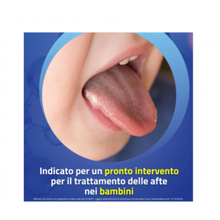 Aftamed Junior Gel Orale Trattamento Afte Bambini 10 ml
