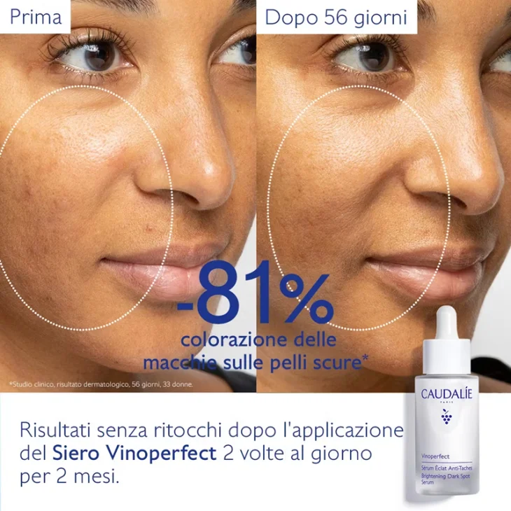 Caudalie Vinoperfect Cofanetto Duo Antimacchie Estate Siero Illuminante 30 ml + Fluido Altissima Protezione 20 ml