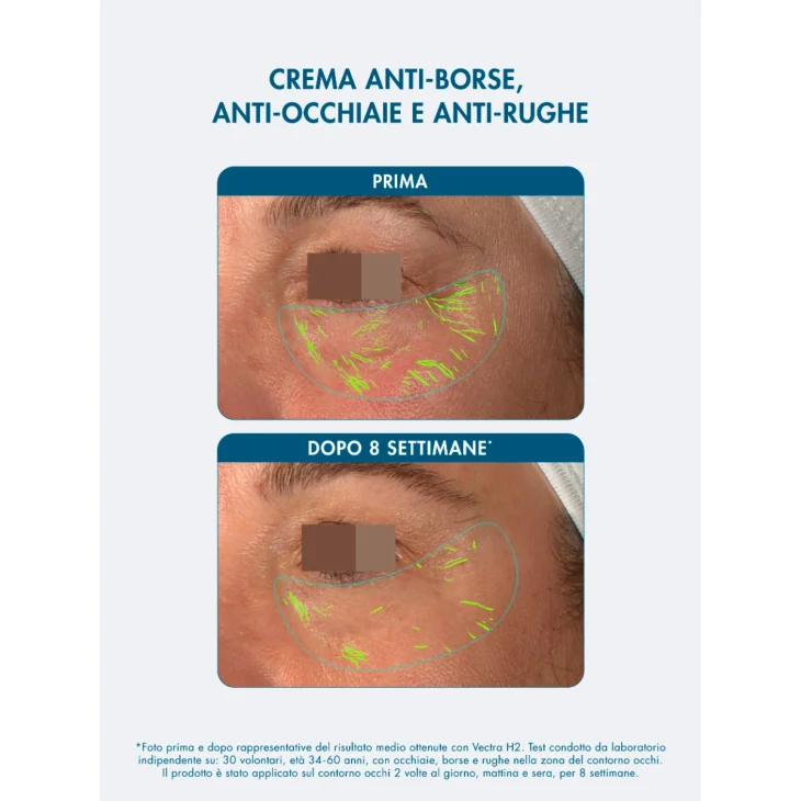 Miamo Supreme Anti Fatigue Eye Cream  Crema Contorno Occhi Anti-borse e Occhiaie 15 ml