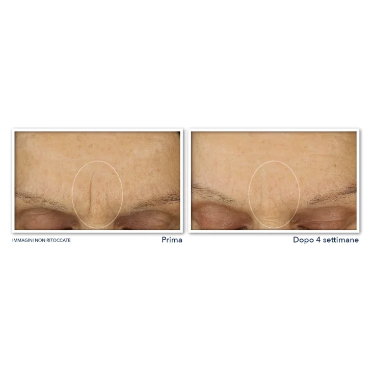 Roc Line Smoothing Retinol Correxion Max Hydration Cream Crema Idratante Antirughe 50 ml