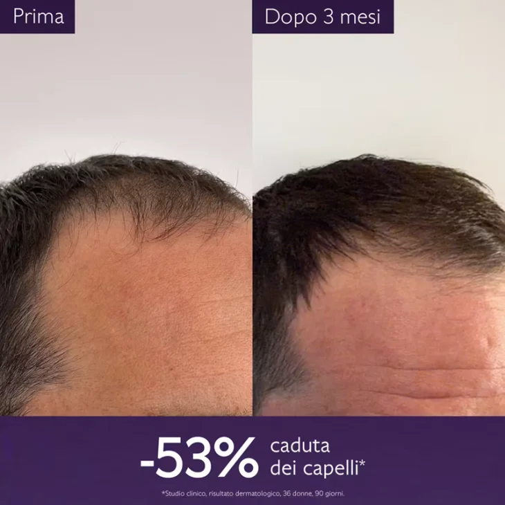 Caudalie Siero Capelli Anticaduta 50 ml