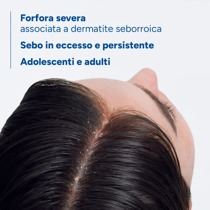Ducray Kelual DS Sebocontrol antiforfora shampoo trattante 100 ml