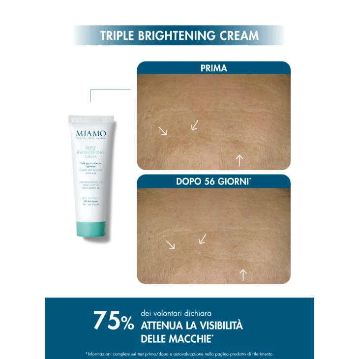 Miamo Protocollo Schiarente Avanzato&Globale Pigment Control Siero 30ml + Supreme Anti-fatigue contorno occhi 5ml + Triple Brightening cream anti-macchie 25ml
