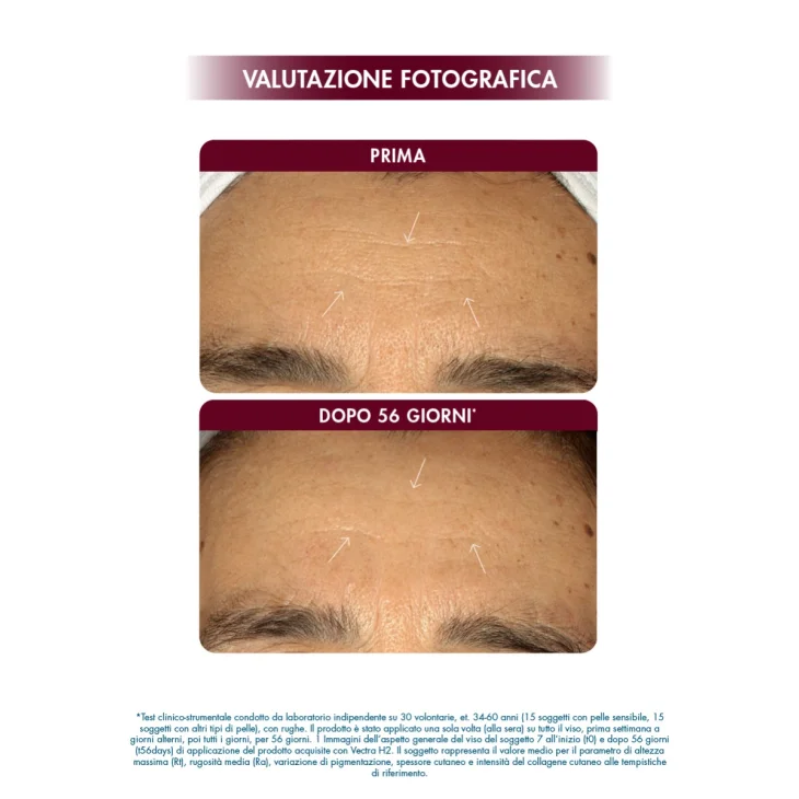 Miamo Tri-Retinoid Surge Resurfacing Serum Siero Notte Anti-Rughe Profonde Multi-Correttivo 30 ml