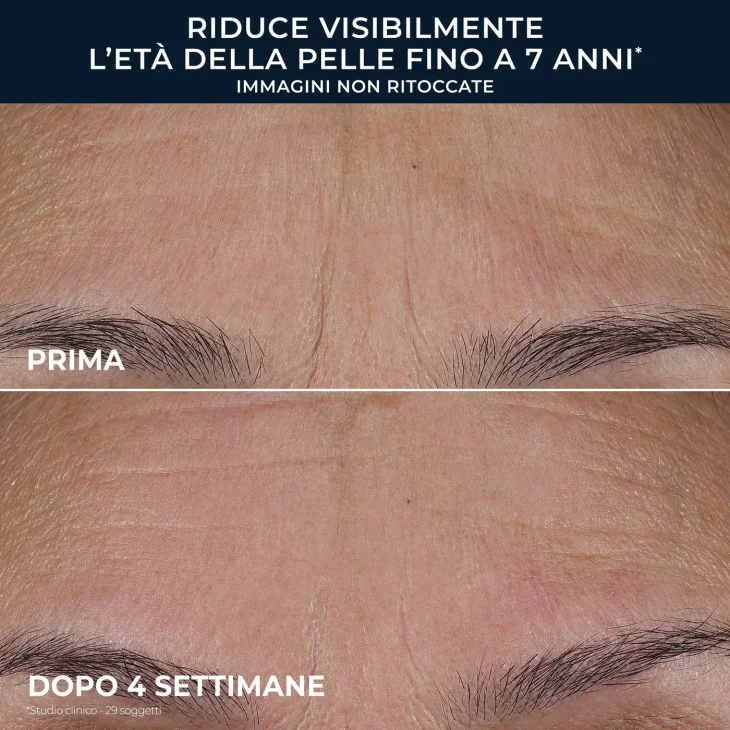 Roc Line Smoothing Retinol Correxion Triple Serum siero viso tripla azione 30 ml