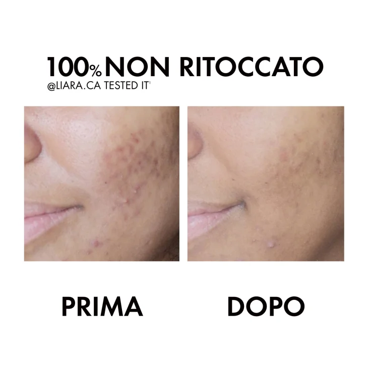 Vichy Normaderm Phytosolution Trattamento Correttivo Quotidiano Doppia Azione