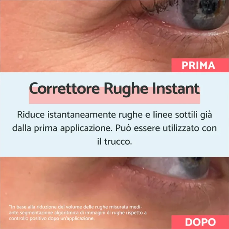 Remescar Correttore Rughe Istantaneo 8 ml 180 applicazioni