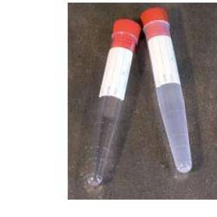 Provetta Conica Per Urina 10ml