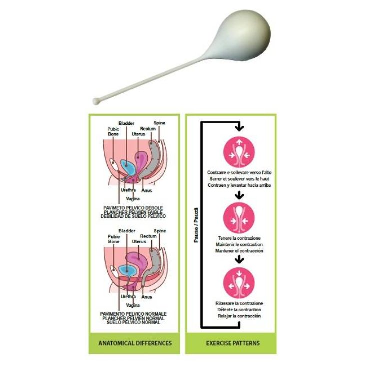 Pelvik L 1 Cono Vaginale