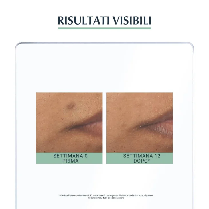 Eucerin DermoPurifyer Siero Tripla Azione Contro le Macchie Post Acne 40 ML