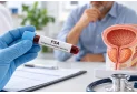 Esame PSA: a cosa serve, come si fa e quando farlo