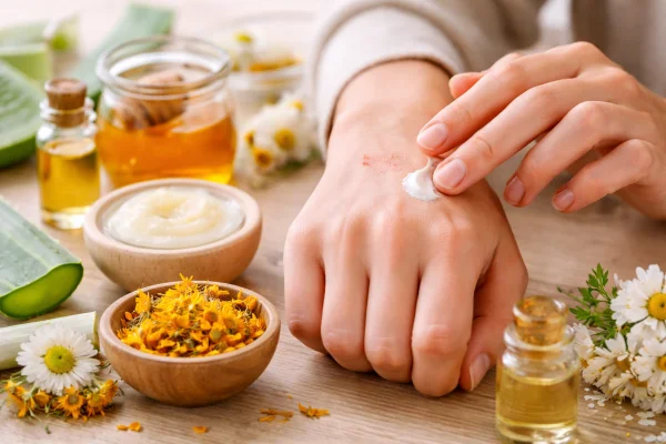 Cicatrizzanti naturali potenti per ferite: quali scegliere