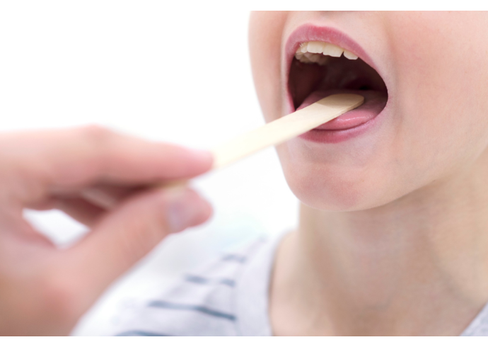 Streptococco: quali sono i sintomi e come si cura? Streptococco: quali sono i sintomi e come si cura?