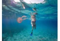 Puntura di meduse: sintomi, cause e rimedi