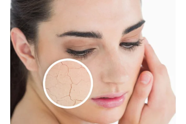 Detersione e idratazione della pelle secca