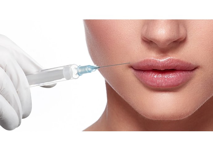 Rivitalizzare il viso con i filler Rivitalizzare il viso con i filler