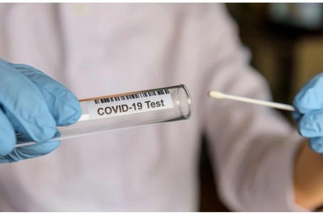 Tamponi COI: i nuovi test da fare in farmacia