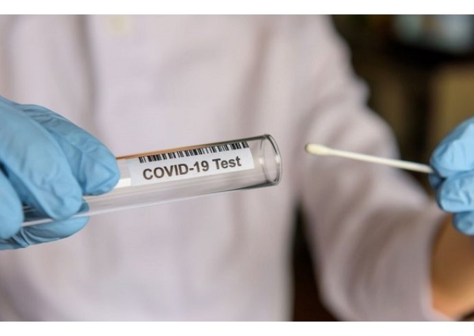 Tamponi COI: i nuovi test da fare in farmacia Tamponi COI: i nuovi test da fare in farmacia