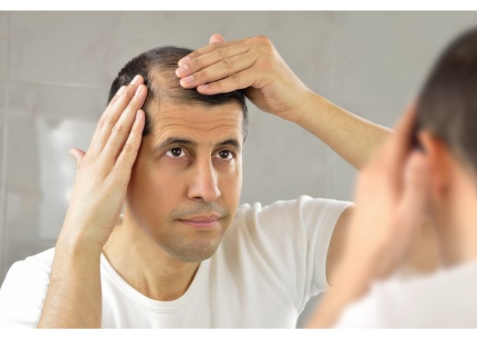 Alopecia: cause, rimedi e prodotti utili Alopecia: cause, rimedi e prodotti utili