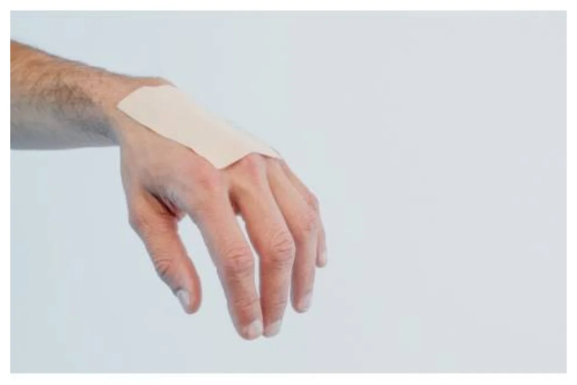 Come curare le ferite e farle guarire velocemente