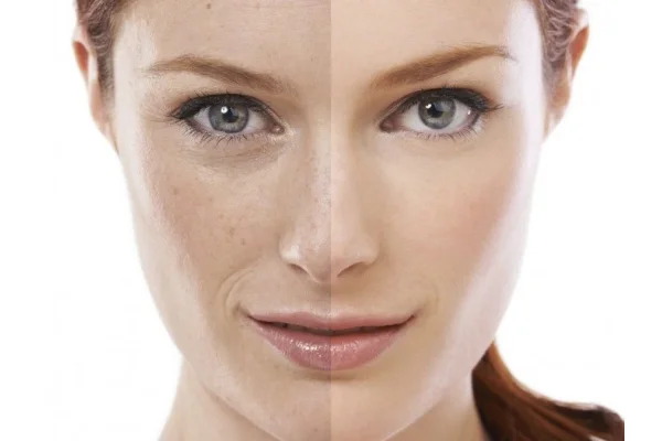 Combatti le macchie della pelle con Eucerin