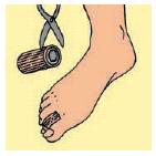 Eumedica Silopad Tubolare con gel su un lato 10 cm